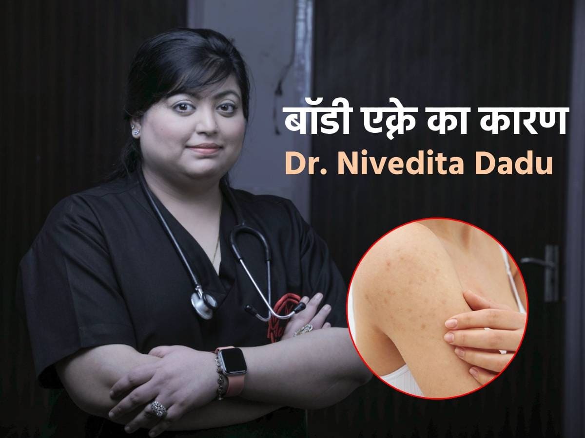 इन 10 कारणों से शरीर पर हो सकते हैं मुंहासे (Body Acne), एक्सपर्ट से