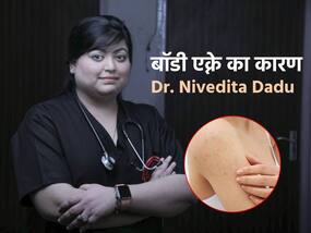 इन 10 कारणों से शरीर पर हो सकते हैं मुंहासे (Body Acne), एक्सपर्ट से जानें