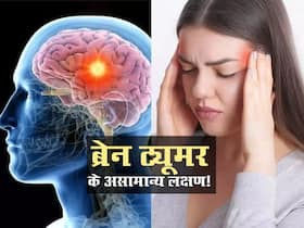ब्रेन ट्यूमर बनने पर शरीर में होते हैं ये 8 बड़े बदलाव! आम से इन लक्षणों को नजरअंदाज करने पर फट सकता है ट्यूमर