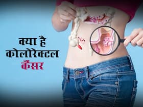 कोलोरेक्टल कैंसर: आंतों से शुरू हो कर मलाशय तक फैल जाता है ये कैंसर, जानें इसके 7 शुरुआती संकेत कोलोरेक्टल कैंसर: आंतों से शुरू हो कर मलाशय तक फैल जाता है ये कैंसर, जानें इसके 7 शुरुआती संकेत
