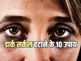 आंखों के नीचे काले घेरे को कम करने के लिए अपनाएं ये 10 उपाय