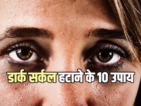 आंखों के नीचे काले घेरे को कम करने के लिए अपनाएं ये 10 उपाय