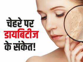 चेहरे पर दिखाई देने वाले ये 3 संकेत बताते हैं आपको होने वाली है डायबिटीज! नजरअंदाज करने पर बढ़ेगा ब्लड शुगर