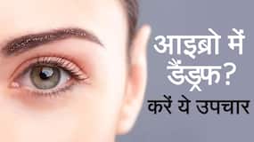 Dandruff Home Remedies: आइब्रो का डैंड्रफ होगा दूर, अपनाएं यह घरेलू नुस्खे, Watch Video