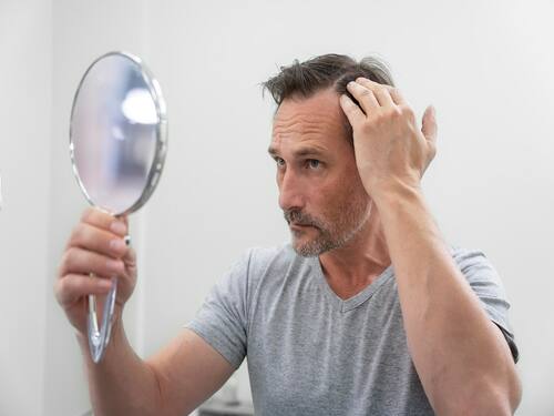 Stress Can Turn Your Hair Grey: Home Remedies To Reverse The Damage |  