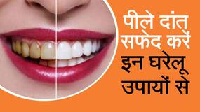 घर पर रखी इन चीजों से पाए मोतियों जैसे सफेद दांत घर पर रखी इन चीजों से पाए मोतियों जैसे सफेद दांत