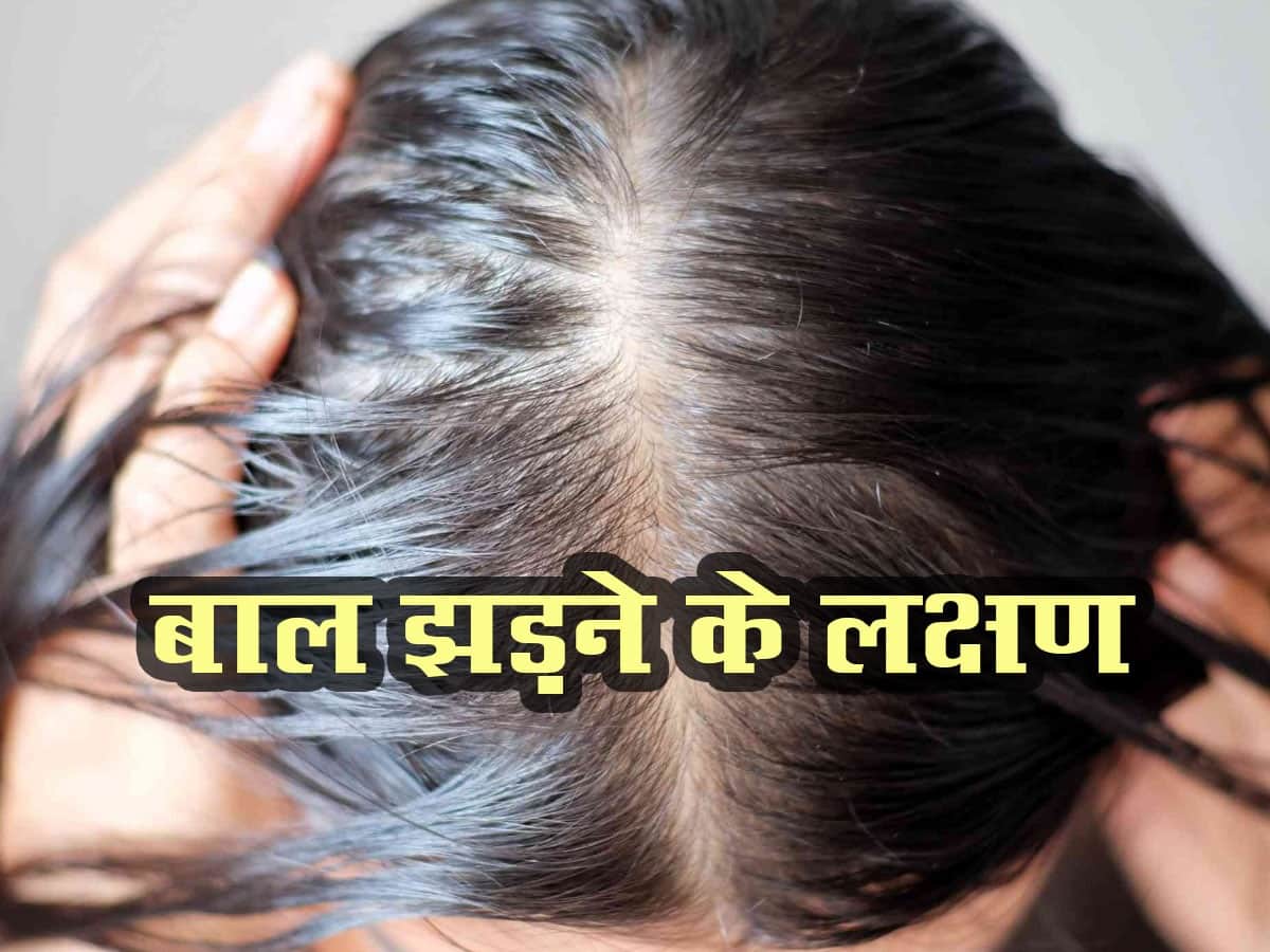 Hair fall early symptoms prevention tips in hindi | बाल झड़ने के लक्षण कारण  और उपचार  हिंदी