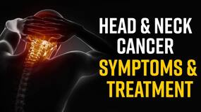 World Head Neck Cancer Day: Know The Symptoms And Treatment Of Head And Neck Cancer, Watch Video