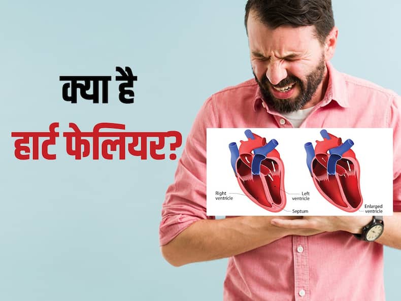 heart-failure