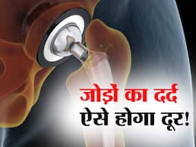 क्या जॉइंट रिप्लेसमेंट सर्जरी वास्तव में राहत दे सकती है? जानें सर्जरी के बाद कौन सी सावधानियां जरूरी क्या जॉइंट रिप्लेसमेंट सर्जरी वास्तव में राहत दे सकती है? जानें सर्जरी के बाद कौन सी सावधानियां जरूरी