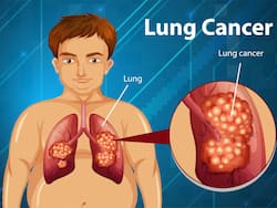 World Lung Cancer Day: How Smoking Increases Lung Cancer Risk?