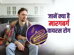 जानें क्या है मारबर्ग वायरस, इसके लक्षण, कारण और इलाज