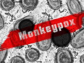 India’s First Monkeypox Death: भारत में मंकीपॉक्स से केरल में पहली मौत, UAE से लौटा था युवक