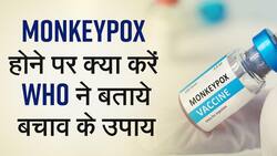 Monkeypox Treatment: मंकीपॉक्स होने पर क्या करें, जानें इससे बचाव के तरीके, Watch Video