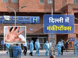 विदेशों से दिल्ली आ रहे यात्रियों में दिख रहे हैं मंकीपॉक्स के लक्षण, भेजा जाएगा एलएनजेपी अस्पताल
