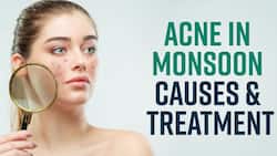 Monsoon Skin Care: How To Treat Acne At Home During Monsoon Season, Watch Video