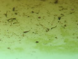 Mumbai Witnesses Another Spike In Vector Borne Diseases: Doctors Say There Will Be More