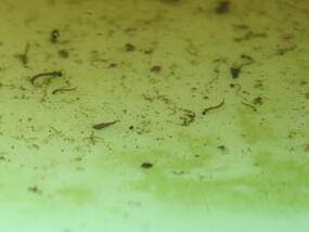 Mumbai Witnesses Another Spike In Vector Borne Diseases: Doctors Say There Will Be More