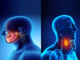 India   s Global Contribution Of Head And Neck Cancer Patients Is Around 57%: Dr Vineet Kaul
