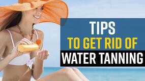 Water Tanning: 5 Remedies To Avoid Water Tan In Summer, Watch Video