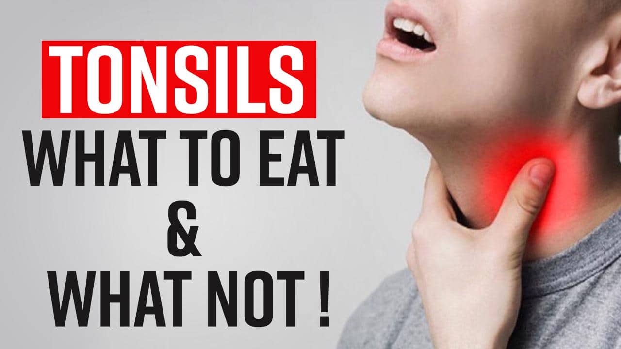 Tonsils Remedies What To Eat And What To Avoid In Tonsils, Watch Video