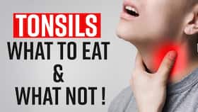 Tonsils Remedies: What To Eat And What To Avoid In Tonsils, Watch Video Tonsils Remedies: What To Eat And What To Avoid In Tonsils, Watch Video
