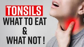 Tonsils Remedies: What To Eat And What To Avoid In Tonsils, Watch Video