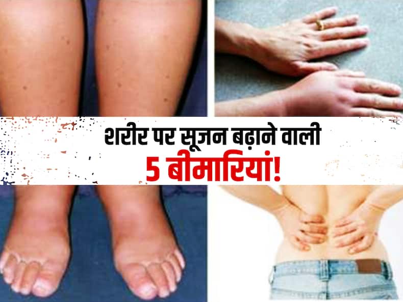 शरीर में छिपी 5 गंभीर बीमारियों की वजह से आ जाती है शरीर पर सूजन! जानें किस बीमारी में कौन सा अंग जाता है सूज