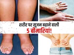 शरीर में छिपी 5 गंभीर बीमारियों की वजह से आ जाती है शरीर पर सूजन! जानें किस बीमारी में कौन सा अंग जाता है सूज