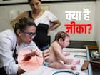 जीका (Zika)