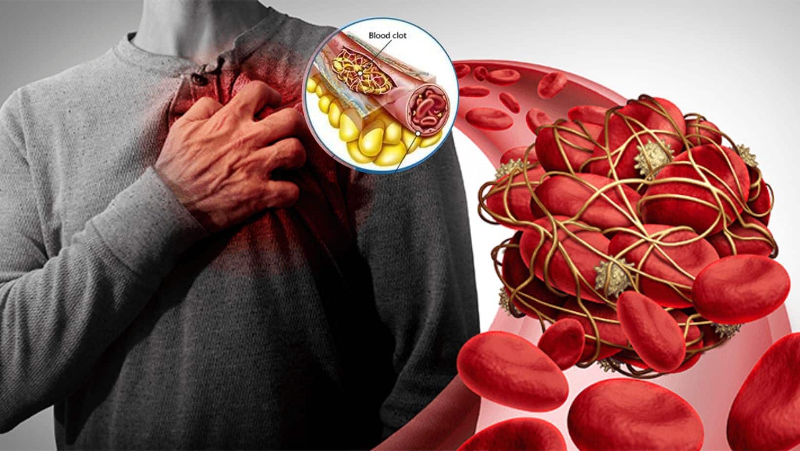 Blood Clotting Disorders 7 Unusual Signs And Symptoms You Should Never