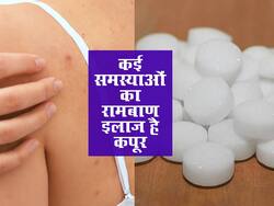 सिर में खुजली या बदन पर दाने, इन 6 समस्याओं में इस्तेमाल करें कपूर