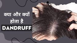 Dandruff: डॉक्टर से जानें क्यों होता है बालों में डैंड्रफ और क्या है इससे बचाव का तरीका, Watch Video