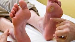 Diabetic Foot: 7 Hidden Symptoms of High Blood Sugar Level That Appear On Your Feet