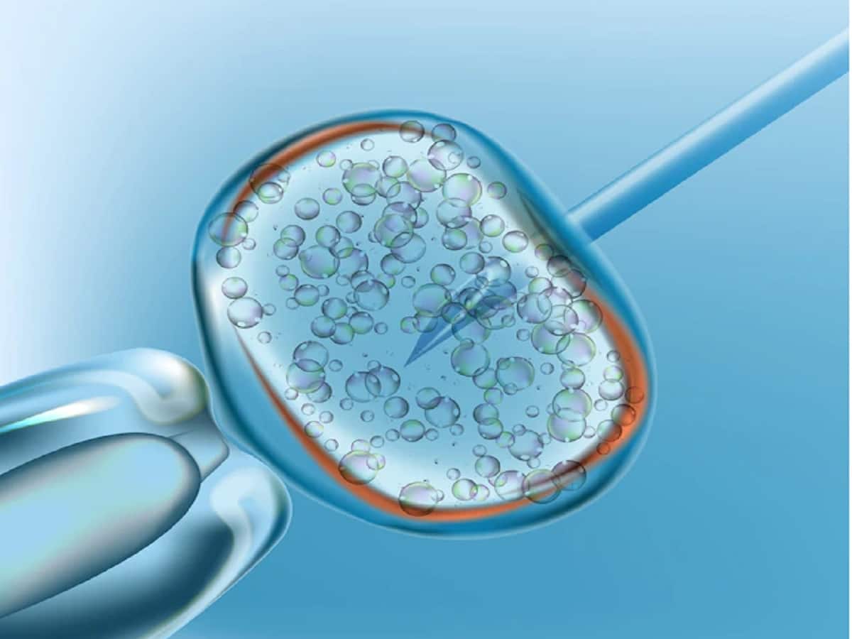 Thoughts on the popularity of ICSI | Journal of Assisted Reproduction and  Genetics