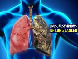16 Unusual Signs and Symptoms of Lung Cancer No One Talks About