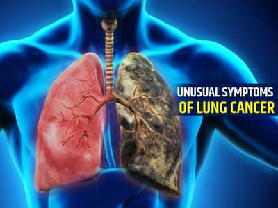 16 Unusual Signs and Symptoms of Lung Cancer No One Talks About ...