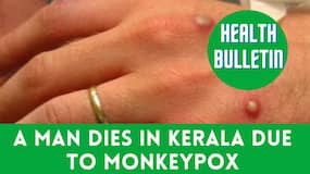 Health Wrap-Up: Twist In The Monkeypox Disease, Kerala Detects African Swine Flu, Watch Video