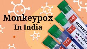 Monkeypox In Delhi: Second Case Confirmed, Nigerian Man Tests Positive