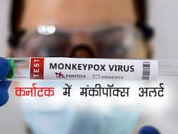 मंकीपॉक्स को लेकर कर्नाटक ने जारी किया सर्कुलर, एयरपोर्ट और रेलवे स्टेशनों पर स्क्रीनिंग के आदेश