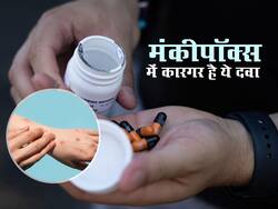 Antiviral tecovirimat: मंकीपॉक्स के इलाज में कारगर है ये एंटीवायरल दवा, रिसर्च में सामने आई बात