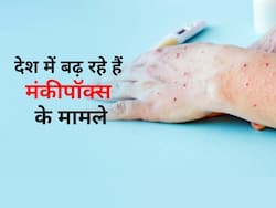 भारत में मंकीपॉक्स संक्रमितों की संख्या हुई 8, जानें देश में अब तक इससे जुड़े सभी बड़े अपडेट्स