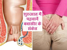 बवासीर की शुरुआत कैसे होती है? जानें इसे पहचानने के 5 संकेत और रोकने के उपाय