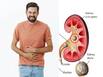 Diet High In Calcium And Potassium May Help Prevent Recurrent Kidney Stones