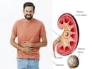 Diet High In Calcium And Potassium May Help Prevent Recurrent Kidney Stones