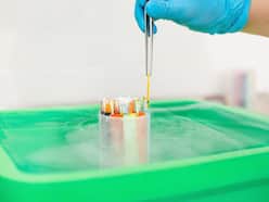 Women! Here Are Some FAQs On Egg Freezing