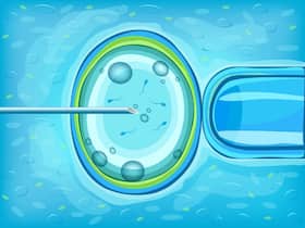Gynaecologist Shares 5 Embryology Secrets For IVF Success