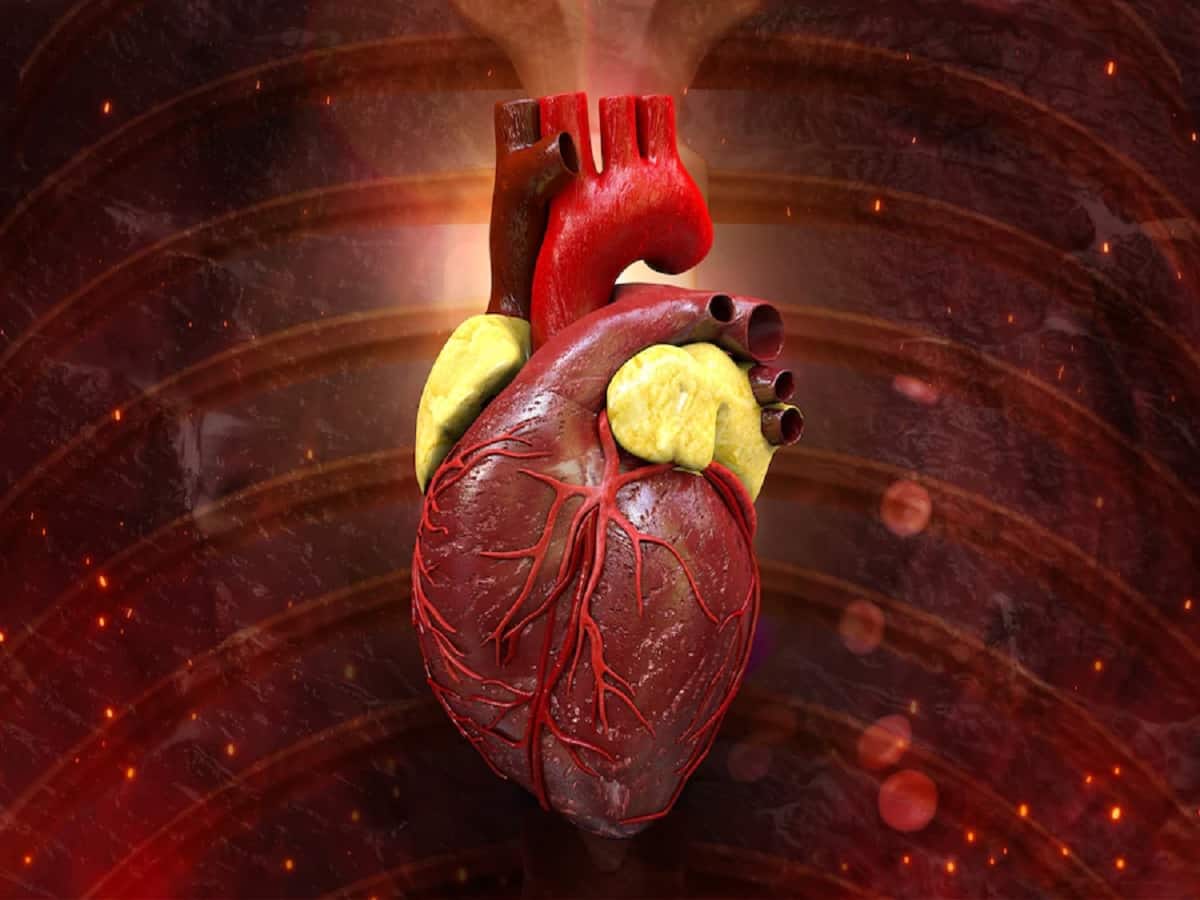 Aortic Aneurysm Is Often Mistaken For A Heart Attack; Here’s Why