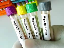 Can Viral Hepatitis Cause Infertility in Men?