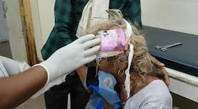 Madhya Pradesh Shocker: Woman's Head Wound Dressed With Condom Packet Sparks Row